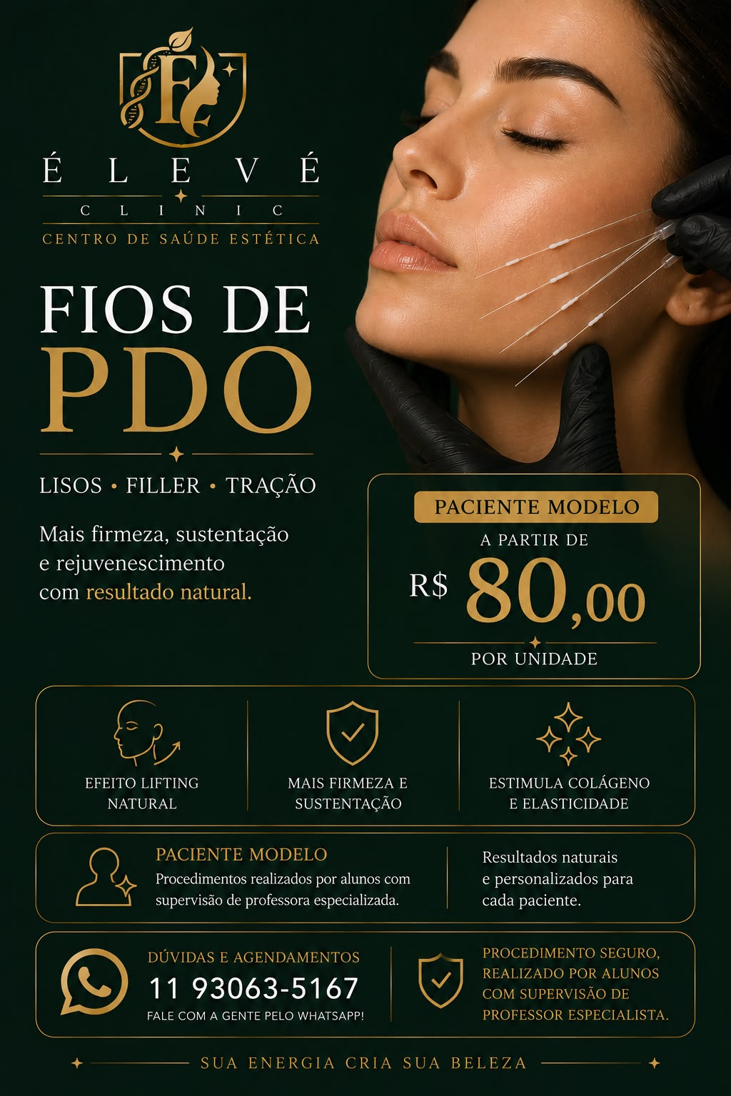 Aplicação de fios de PDO na face