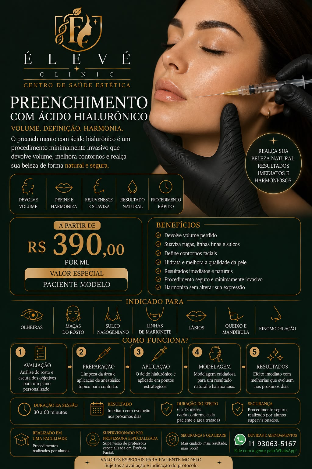 Aplicação de preenchimento com ácido hialurônico no rosto