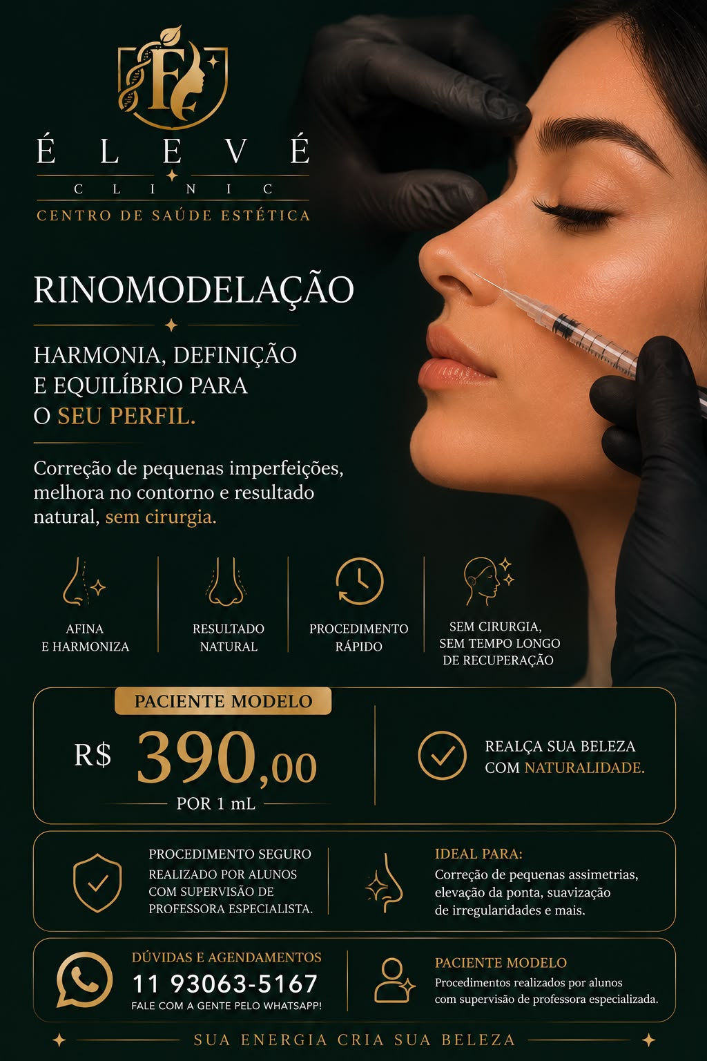 Aplicação de rinomodelação no dorso do nariz