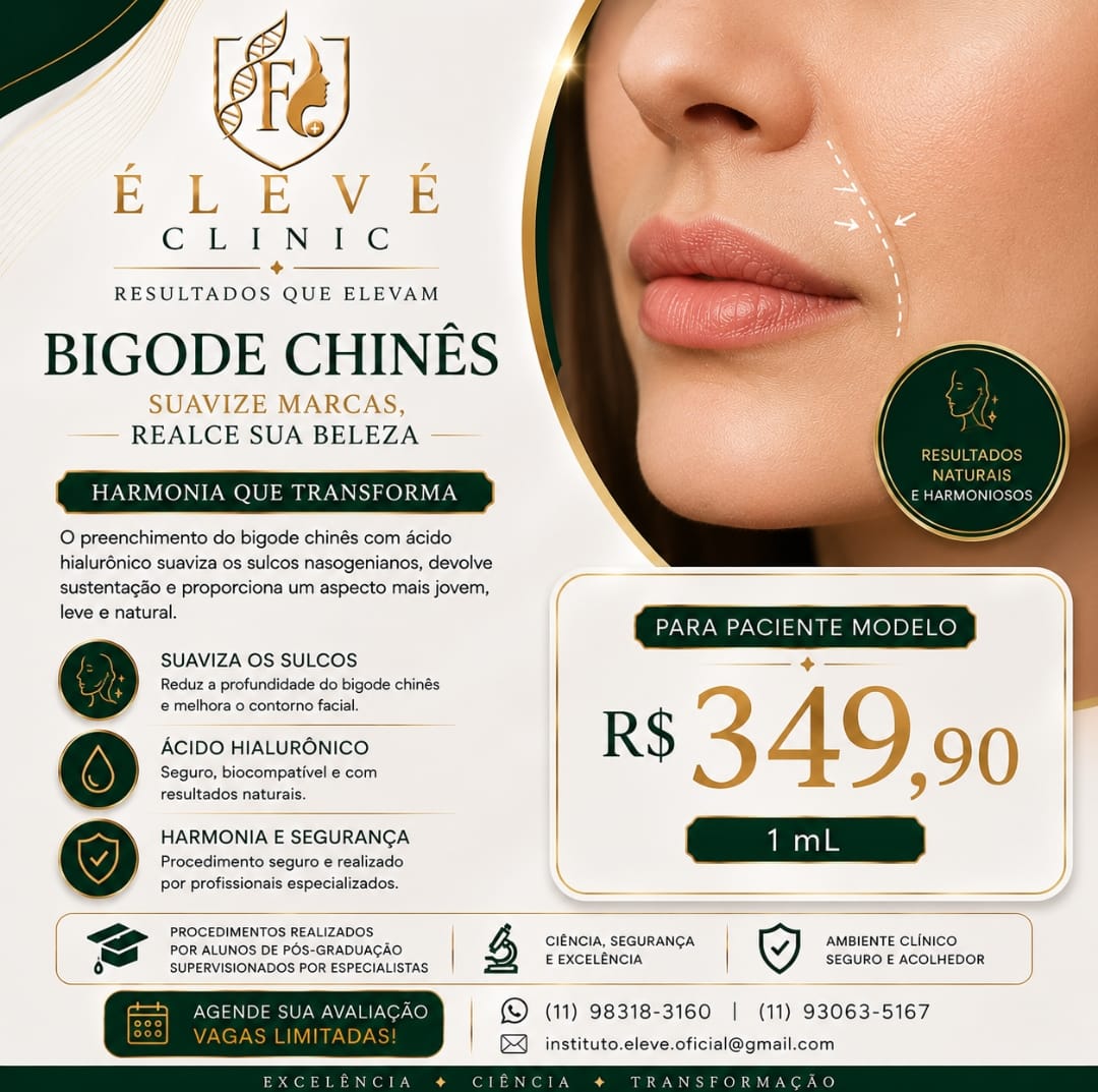 Divulgação de paciente-modelo para preenchimento do bigode chinês