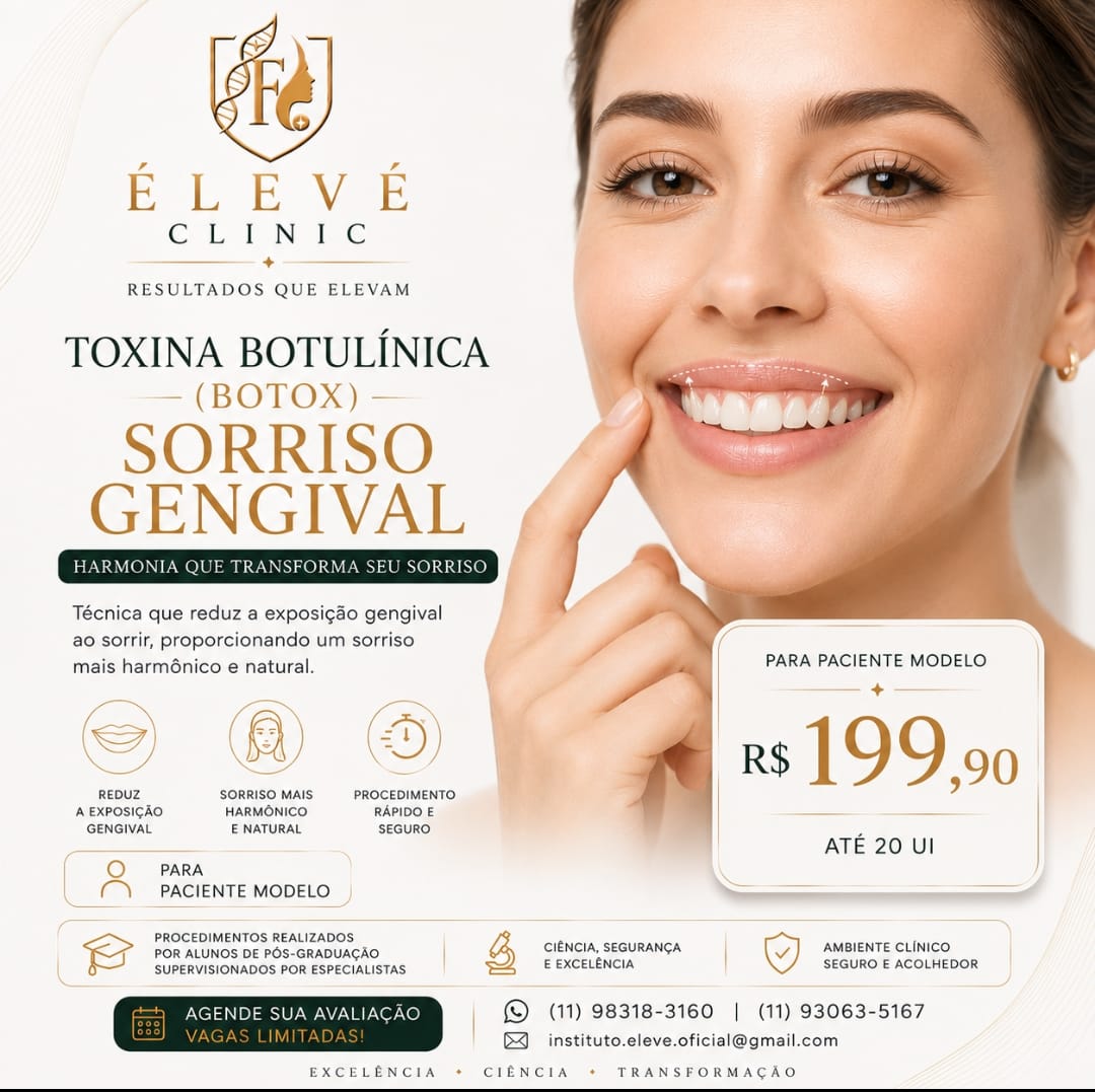 Divulgação de paciente-modelo para toxina botulínica no sorriso gengival